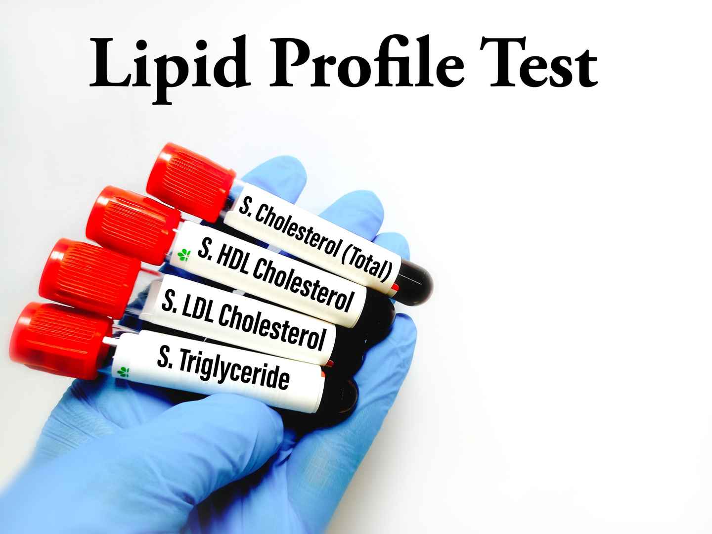 Lipid metabolism diagnostic enzymes