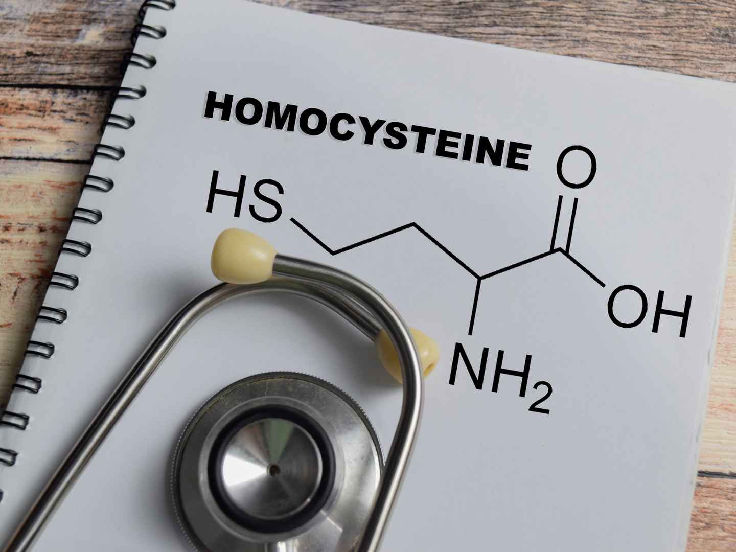 Homocysteine testing