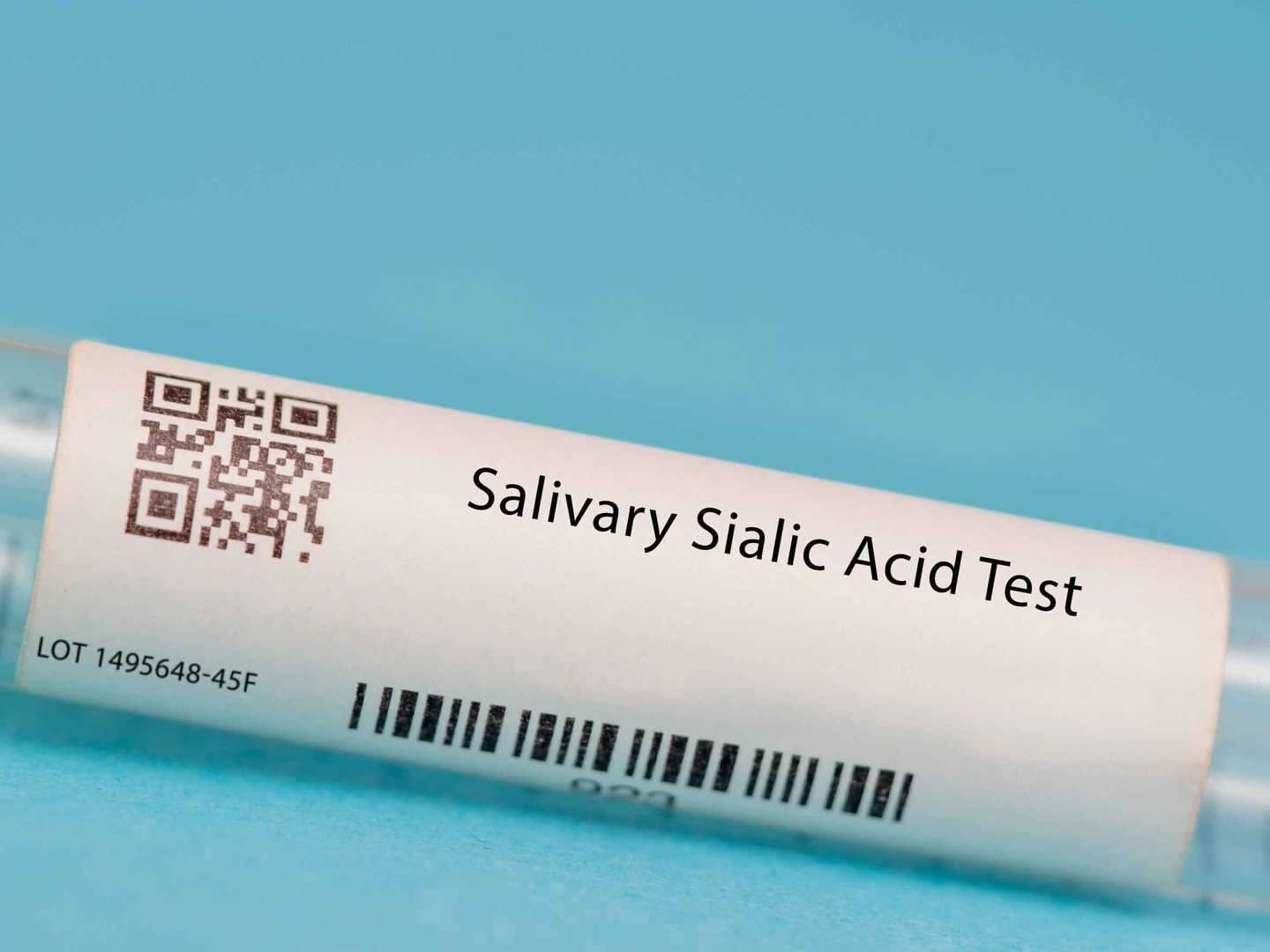 Sialic acid testing
