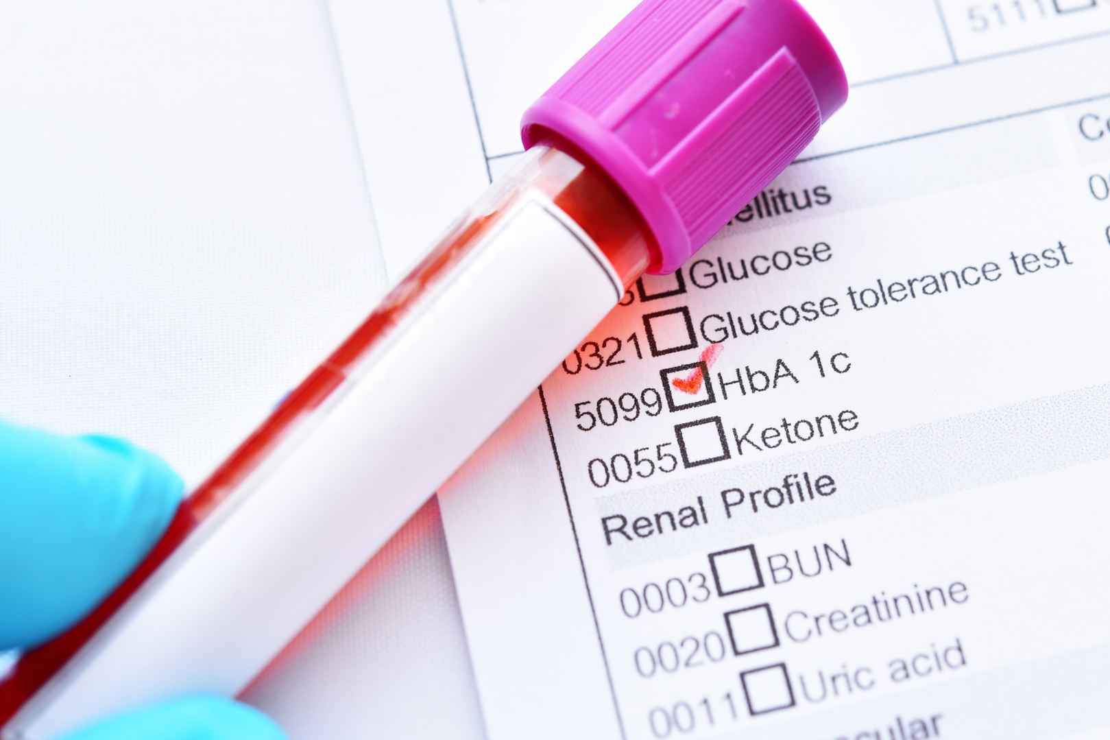 Diabetes and blood glucose testing enzymes