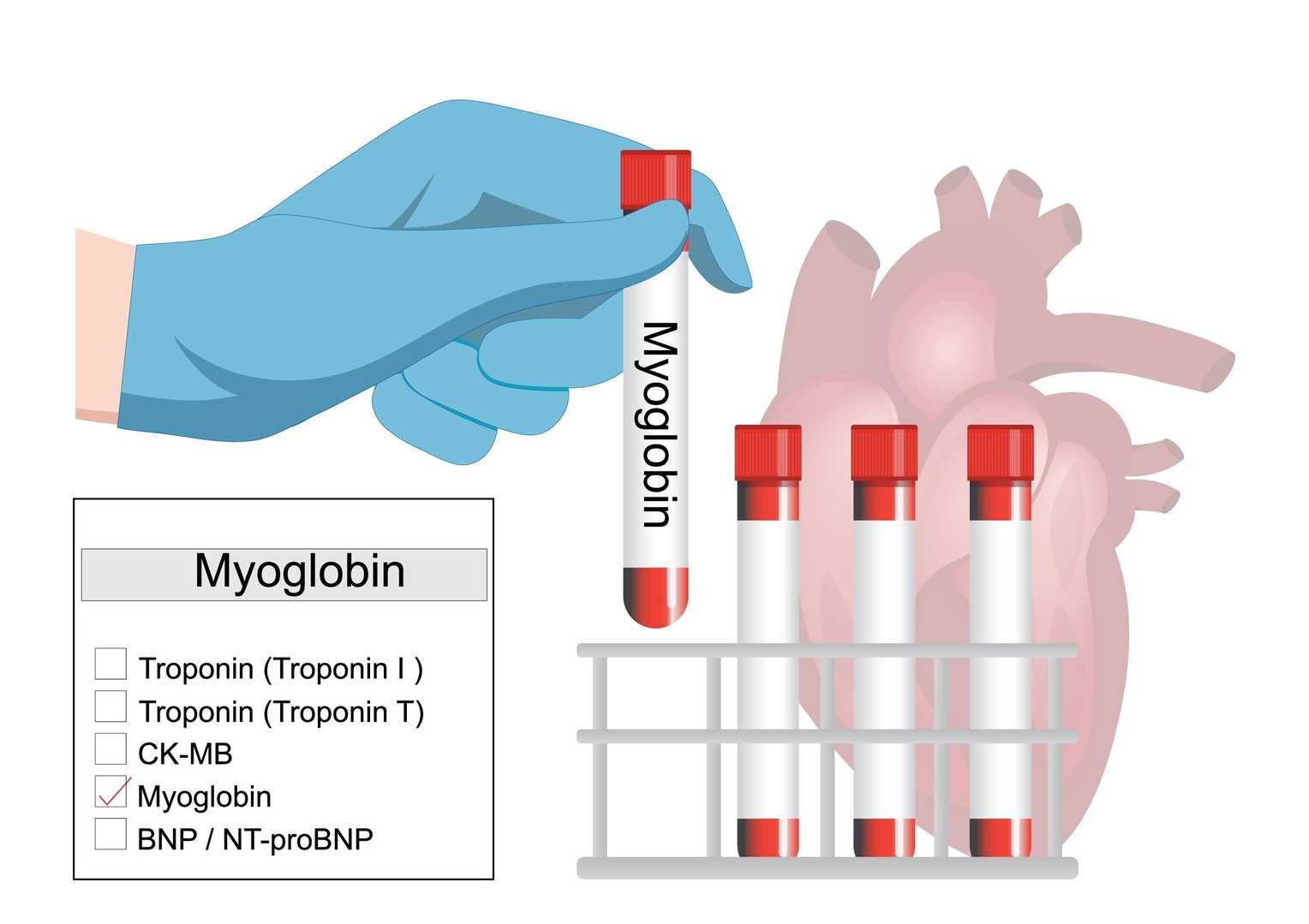 Cardiac and muscle injury assay enzymes