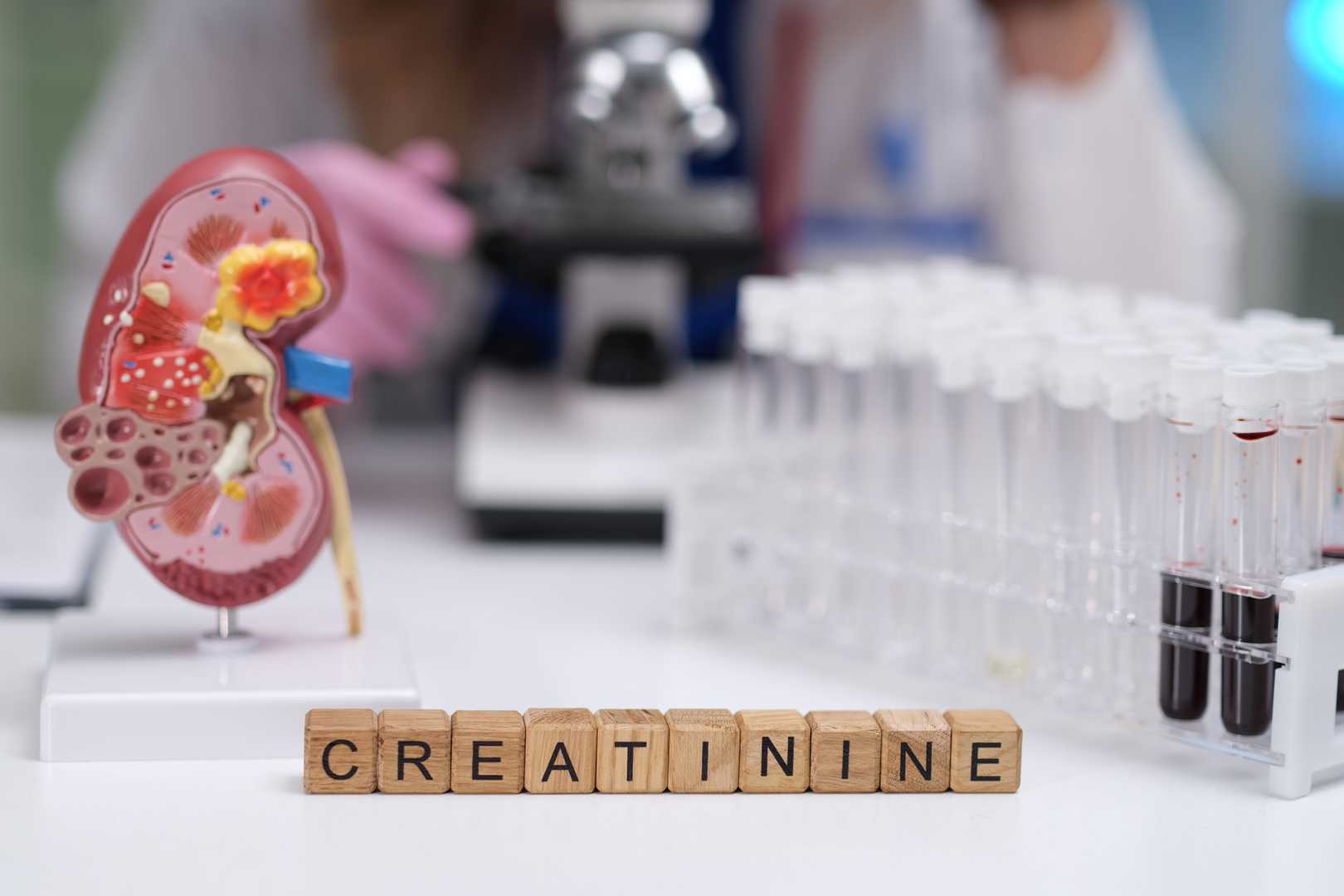 Creatinine assay enzymes and kits