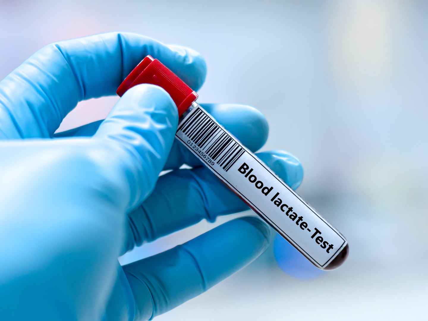 Lactate assay enzymes, analytical reagents, and diagnostic kits