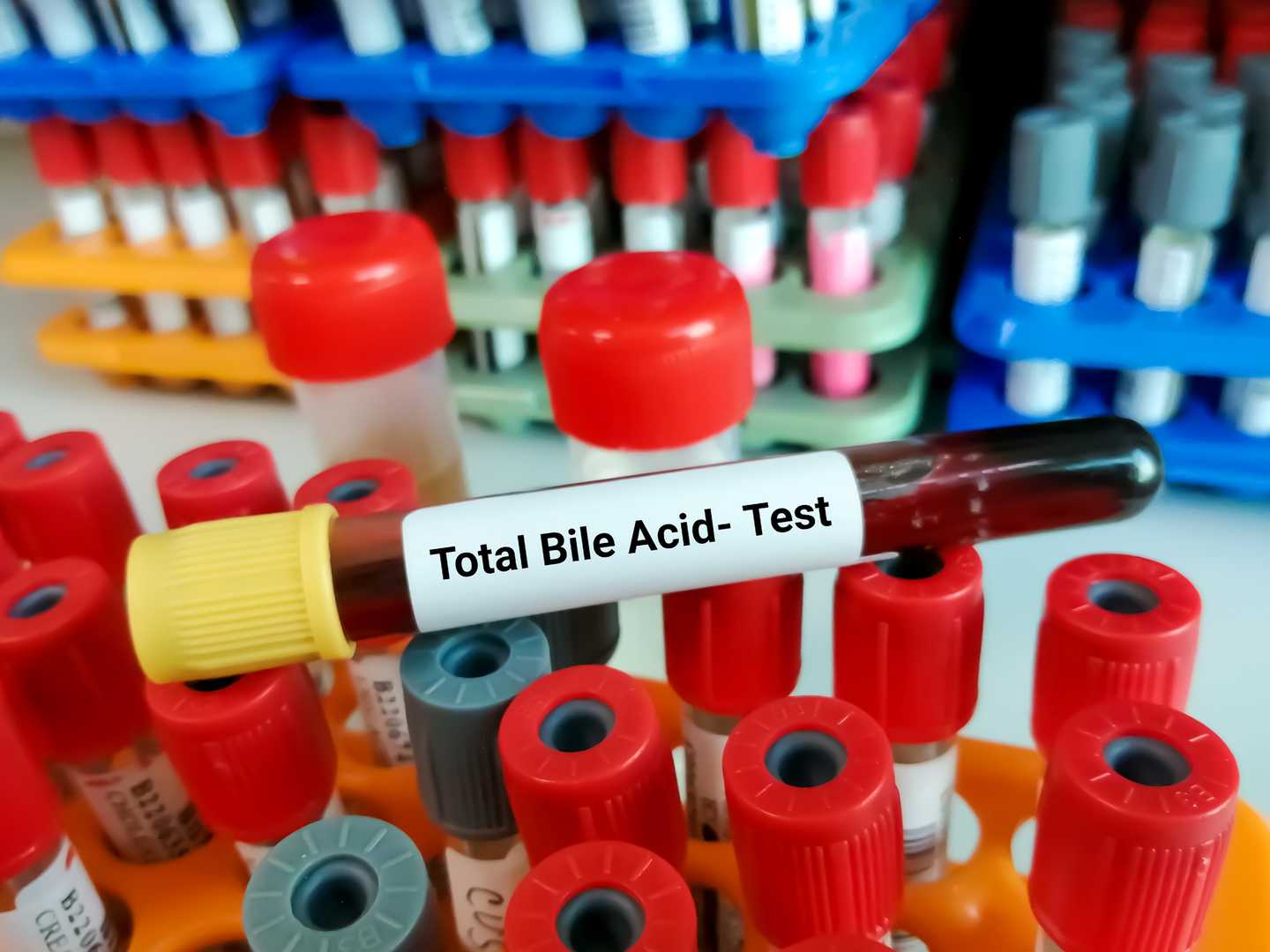 Total bile acid assay