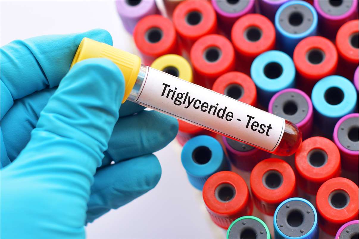 Triglyceride assay enzymes and kits