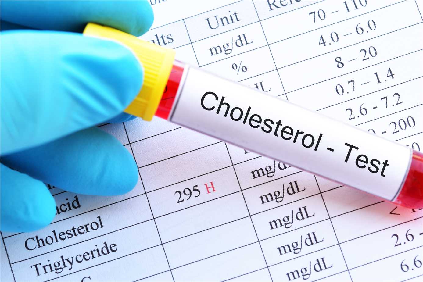 Total cholesterol assay enzymes and kits