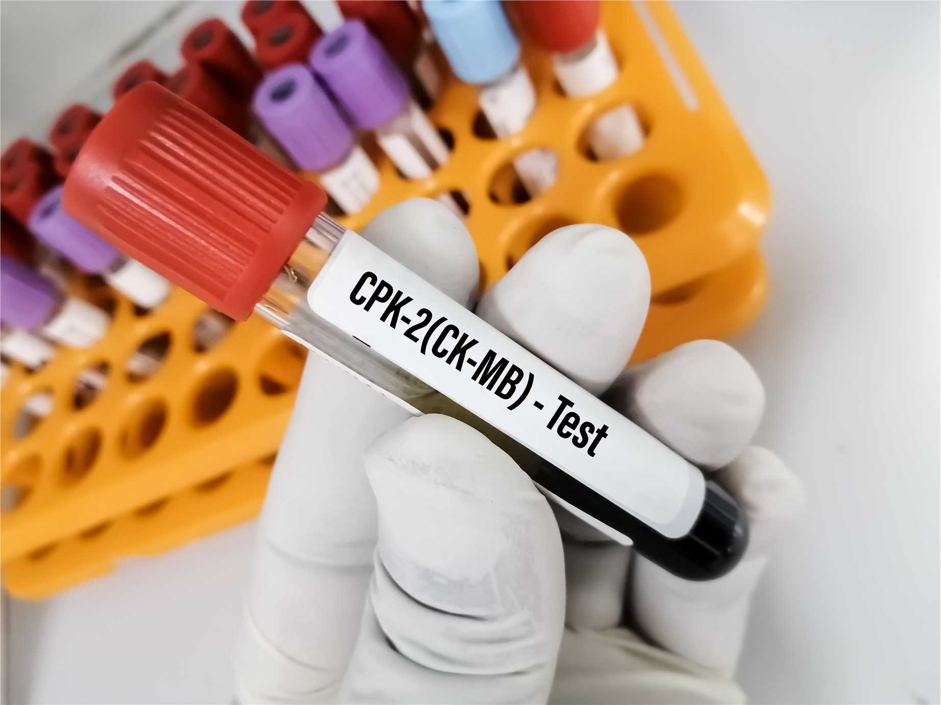 Creatine kinase assay enzymes, CK isoenzyme materials, and diagnostic kits