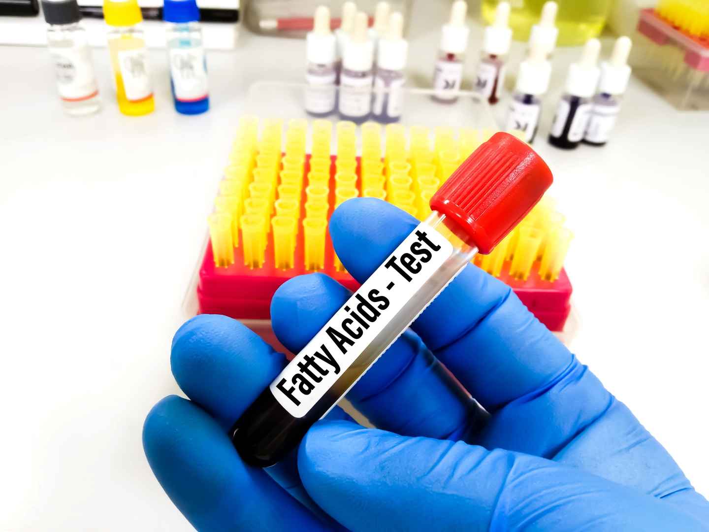 Free fatty acid and NEFA assay enzymes and kits