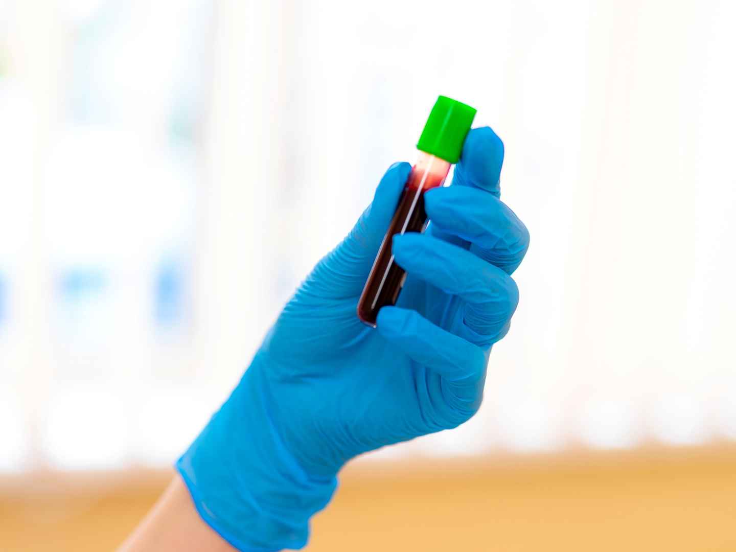 Diagnostic enzymes engineering tailored to blood matrix