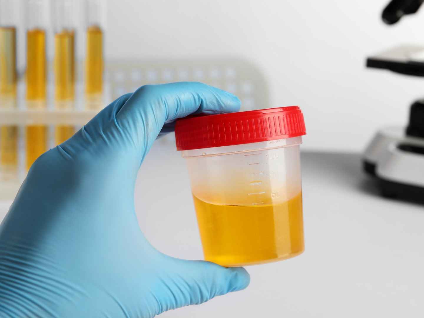 Diagnostic enzymes engineering tailored to urine matrix
