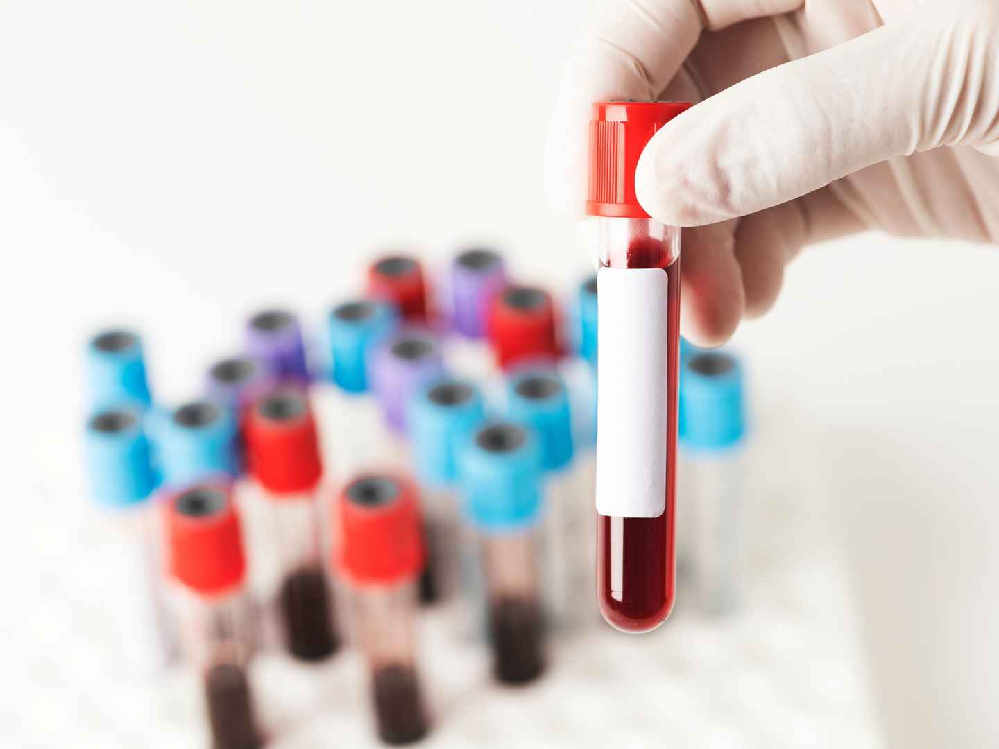 Interference resistance optimization for enzyme-based assays