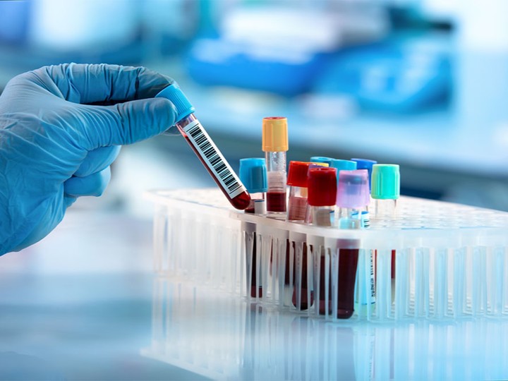 Clinical Chemistry & General Metabolic Testing Enzymes