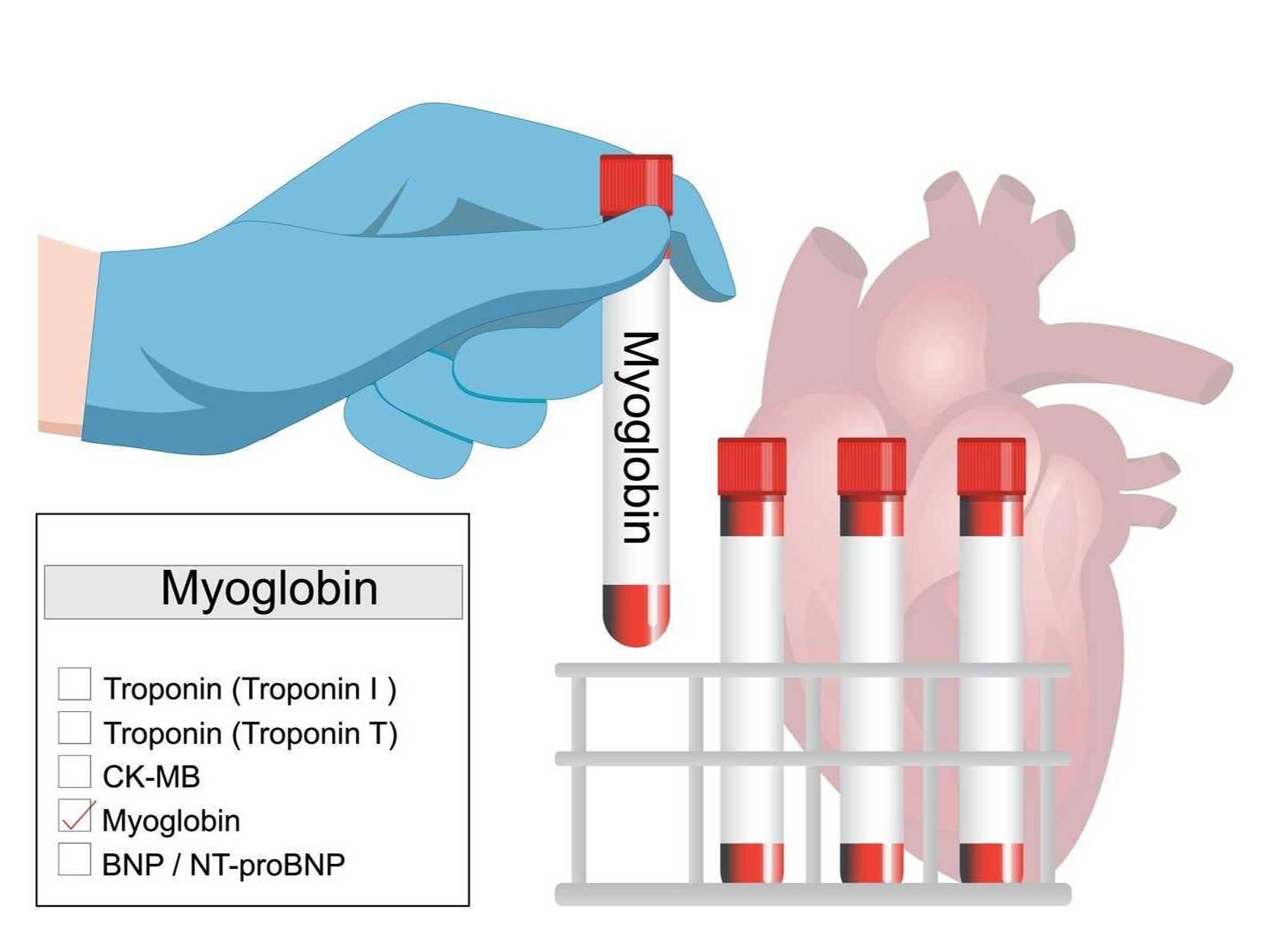 Cardiac and Muscle Injury Assay Enzymes