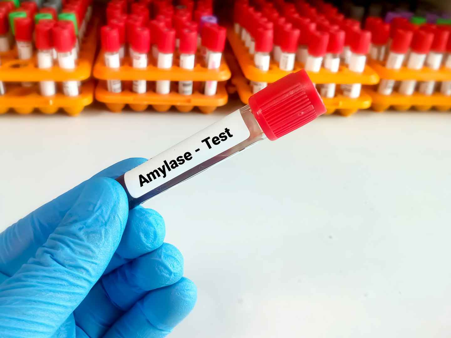 Amylase Assay Reagents & Kits