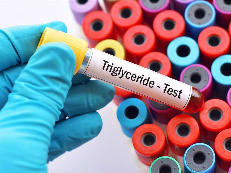 Triglyceride Assay Enzymes & Kits