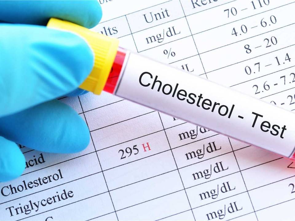 Total Cholesterol Assay Enzymes & Kits