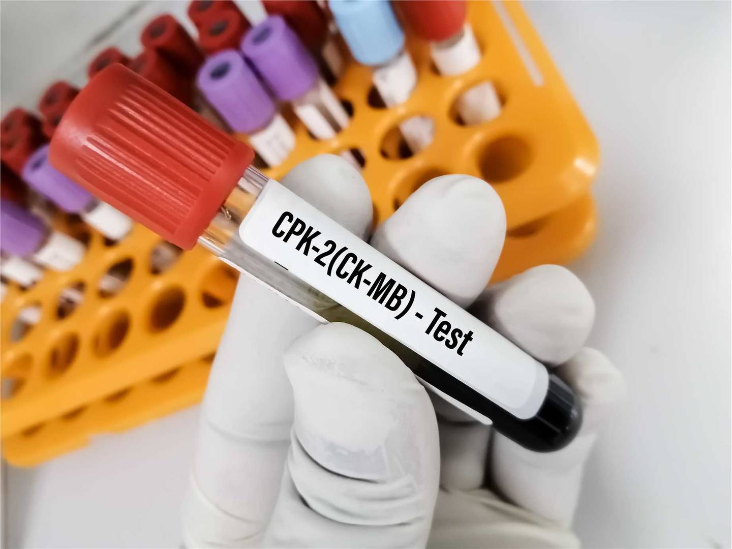 Creatine Kinase Assay Enzymes & Kits