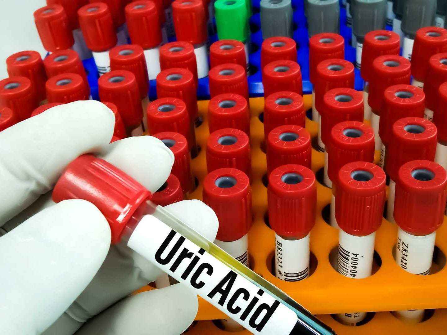 Uric Acid Assay Enzymes & Kits