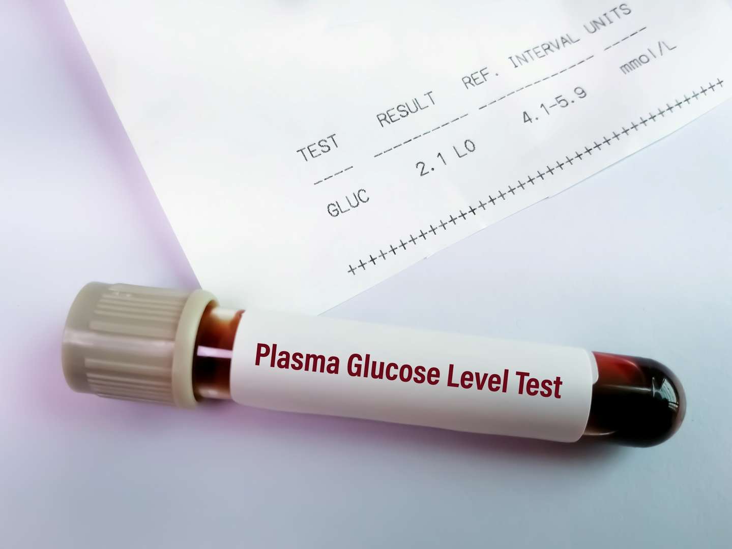Glucose Assay Enzymes & Kits