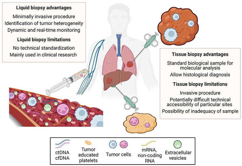 Tissue and plasma preanalytical pathways before molecular CDx analysis